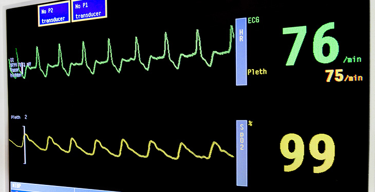 Heart monitor output